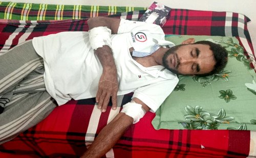 কুষ্টিয়ায় কুমারখালীতে বেড়াতে গিয়ে হামলার শিকার দম্পতি