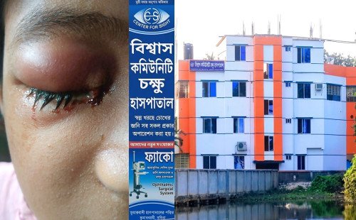 ভুল চিকিৎসা ও অনিয়মের অভিযোগ, কুমারখালীর বিশ্বাস চক্ষু হাসপাতালে তদন্তের দাবি